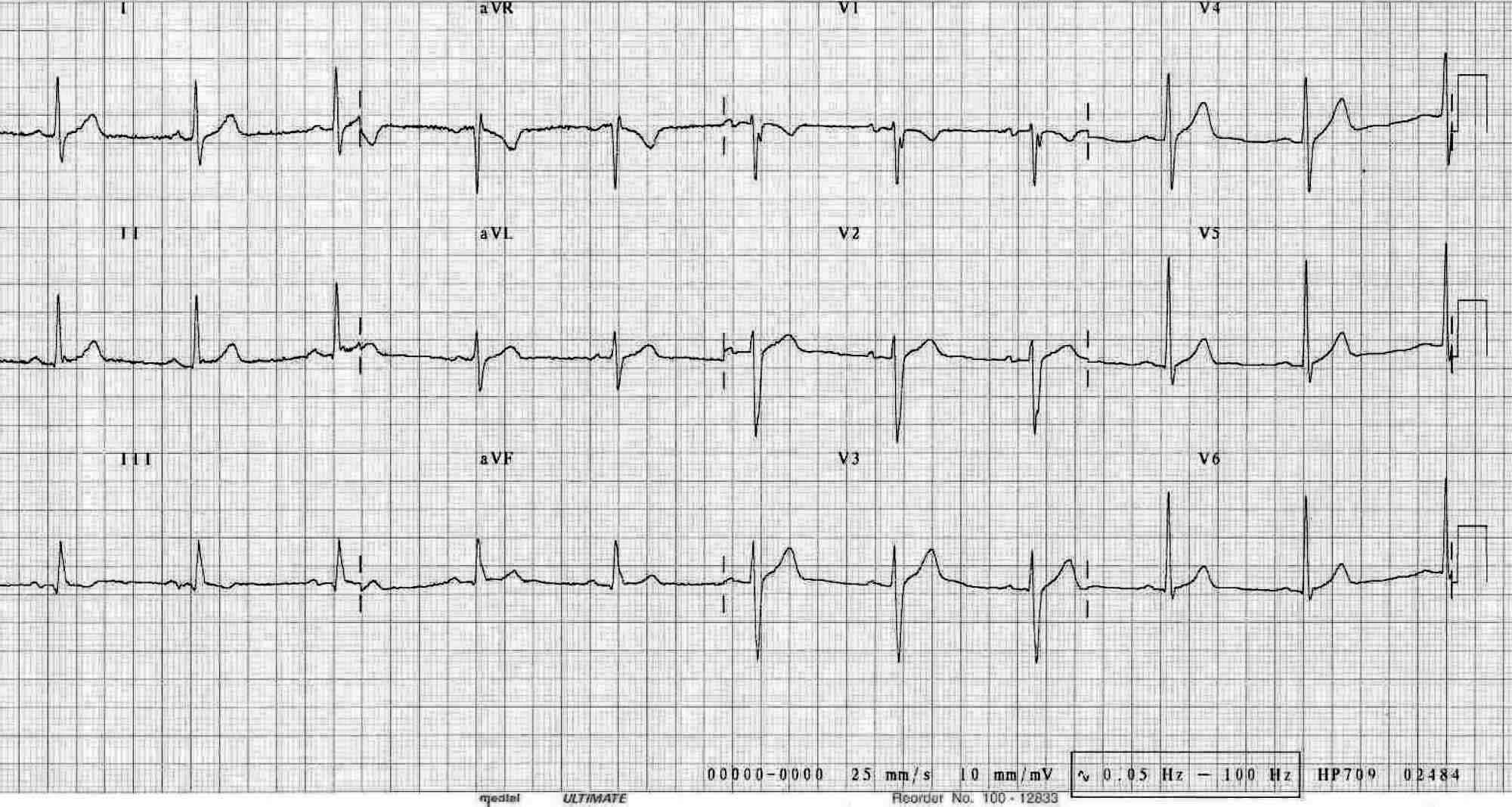 AMRG Cardiac Atlas – Cardiac Atlas Project